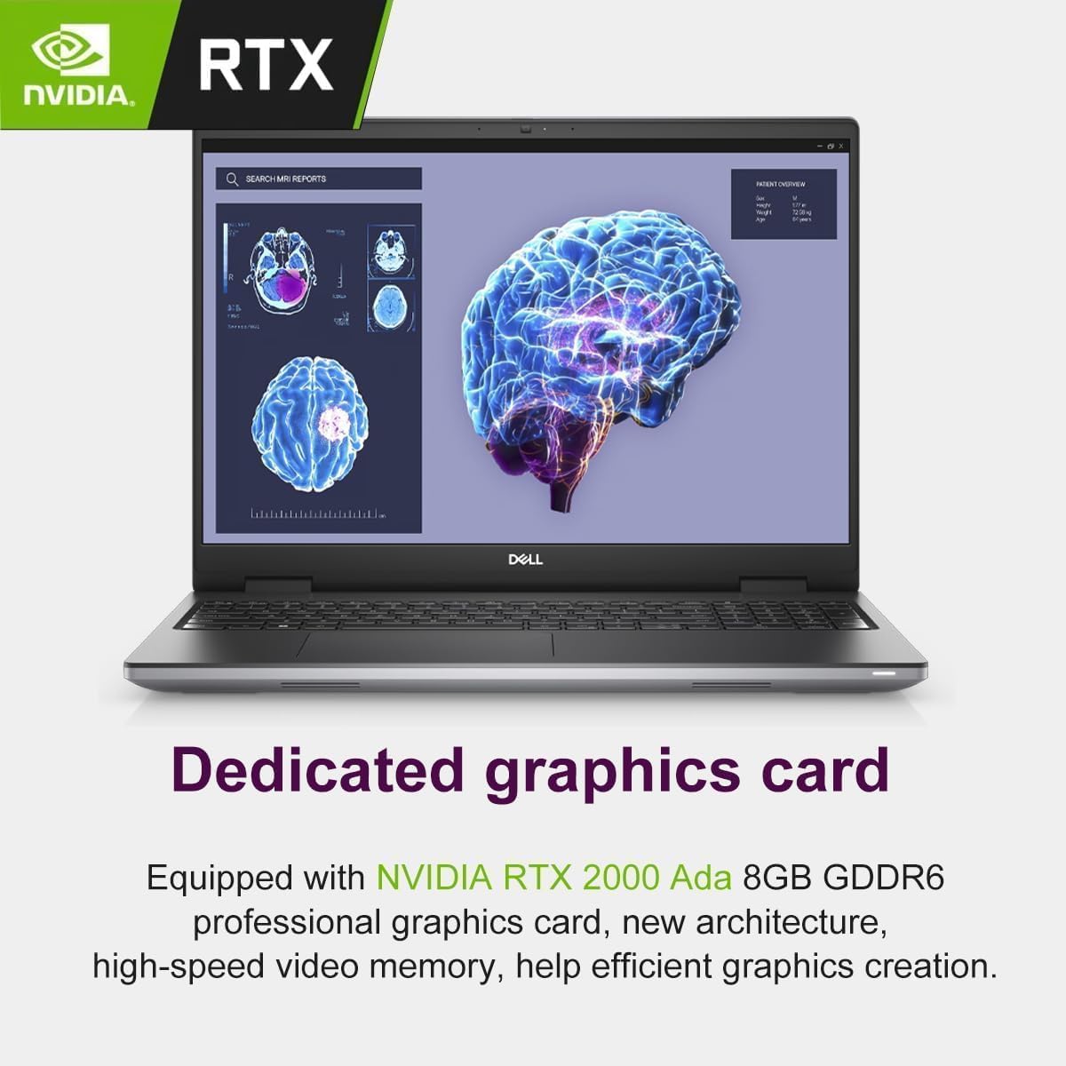 Dell Precision 7000 7780 Mobile Workstation Laptop, NVIDIA RTX 2000 Ada 8GB, 17.3" FHD, Intel 24-Core i9-13950HX (>Ultra 7-165H), IST Computer Customized 32GB LPCAMM2 DDR5 RAM, 1TB/2TB SSD, Win 11 Pro