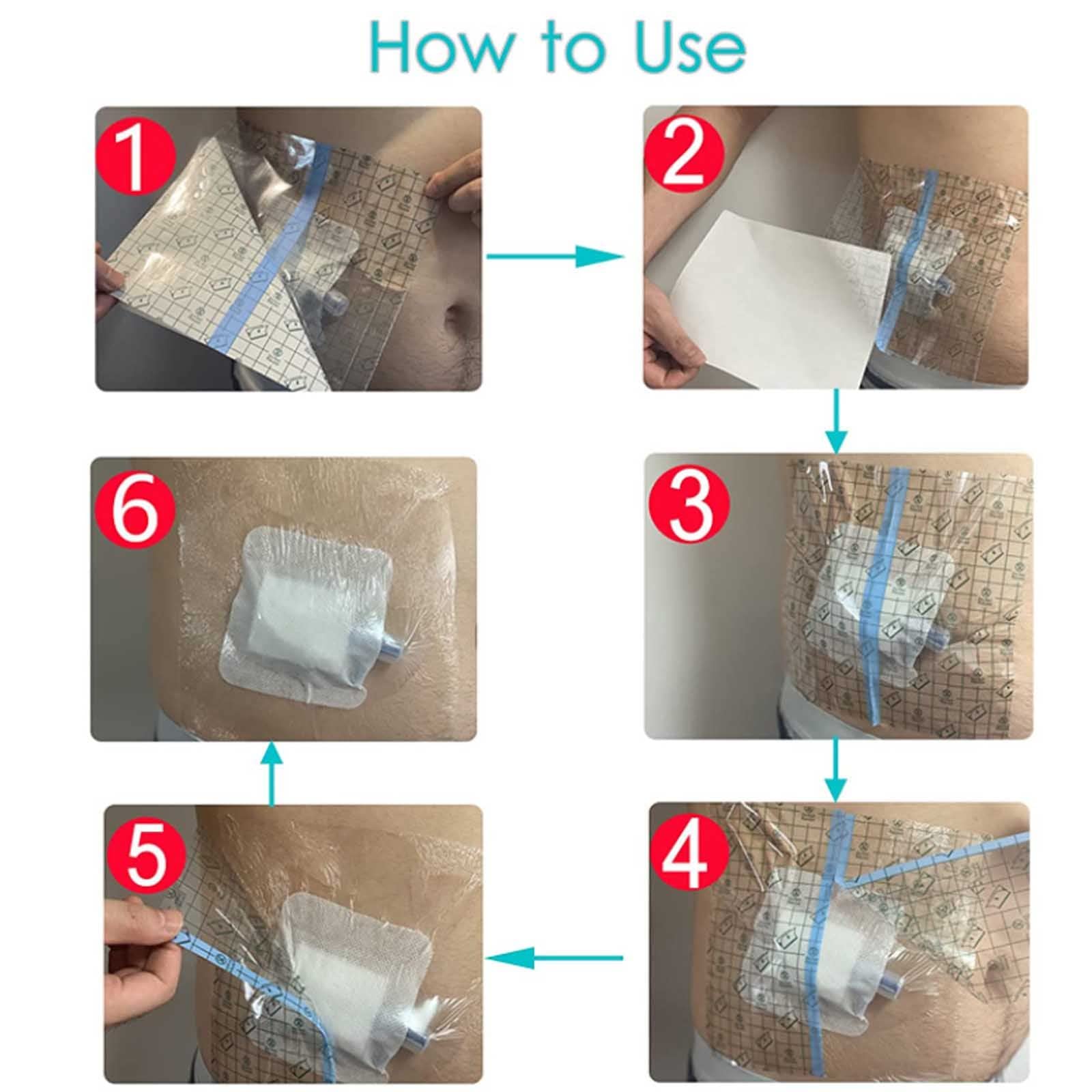 100pcs Benda Adesiva Elastica Impermeabile,Pd Catetere Per Dialisi Copertura Per Doccia Scudi Per Ferite Per Il Petto Peritoneale Porta Chemio Pellicola Trasparente Protezione Della Barriera ,15×18cm