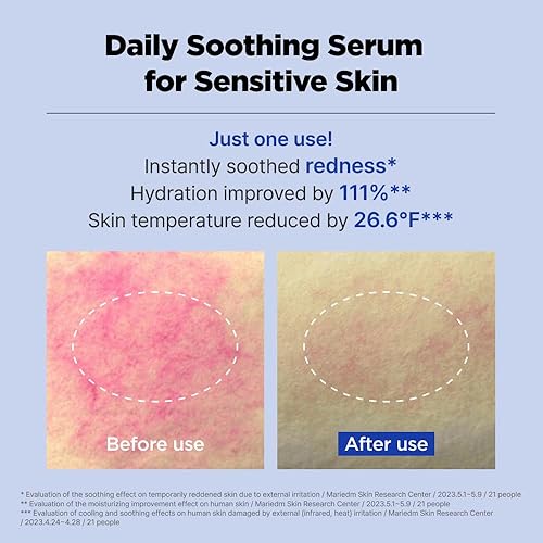 Miniatura 2 de ACNI Dr. 1st Control Serum 1.4 fl oz (1.35 oz)