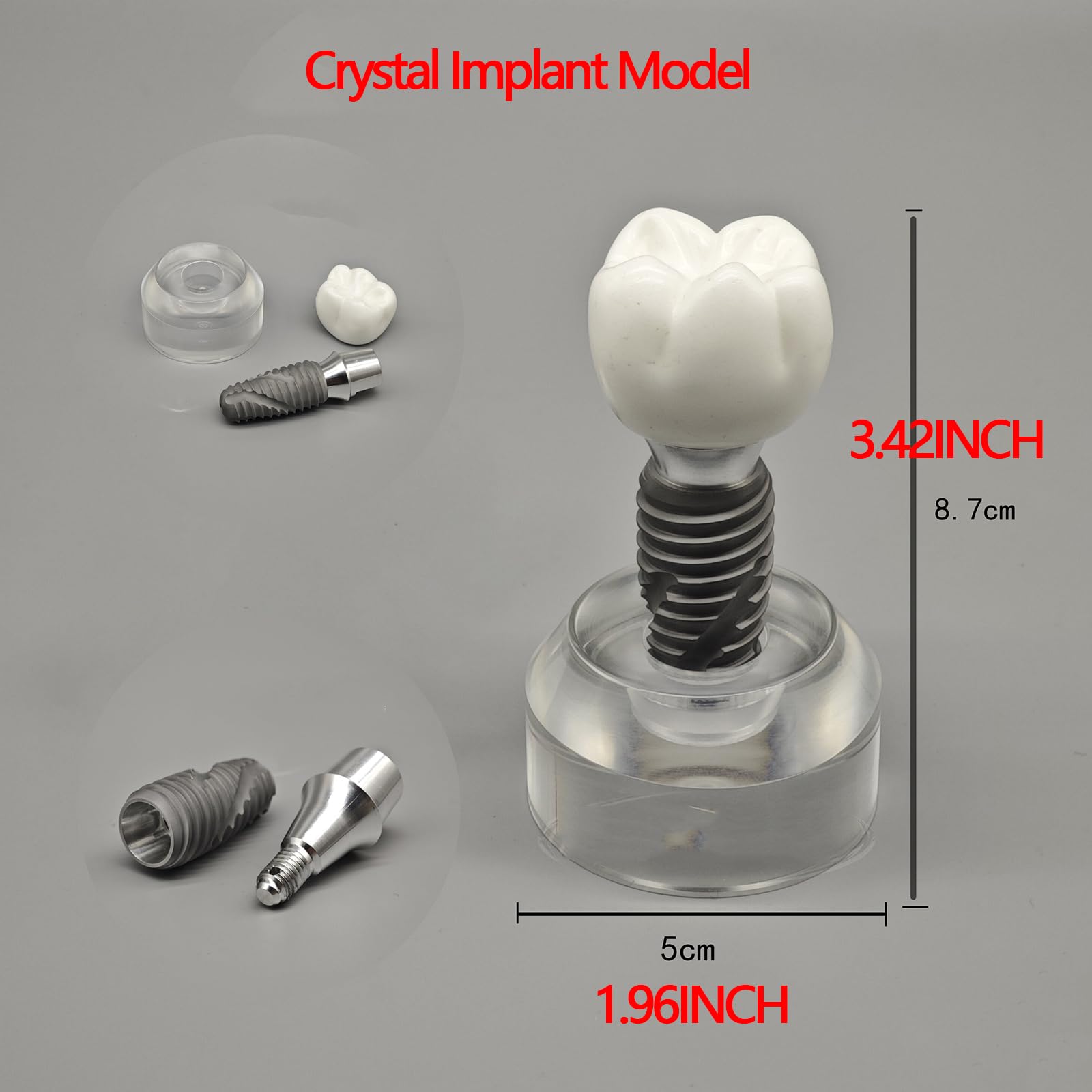 Modello di impianto in Cristallo Modello didattico Dentale e Orale Denti Trasparenti per Studio e insegnamento