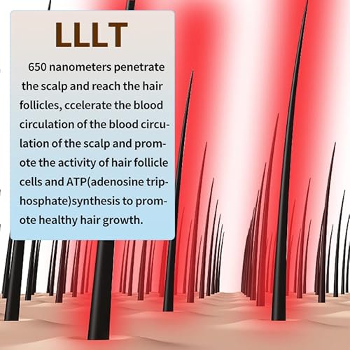 iHelmet Pente de Crescimento de Cabelo A Laser, Terapia A Laser de Baixo Nível de Cabelo, Tratamento