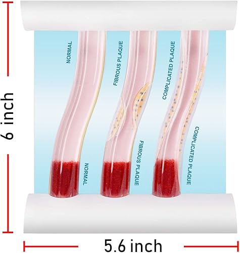 Miniatura 3 de Baja densidad Lipoproteína LDL Blood Vessel Modelo para Médico Paciente Docente Docente