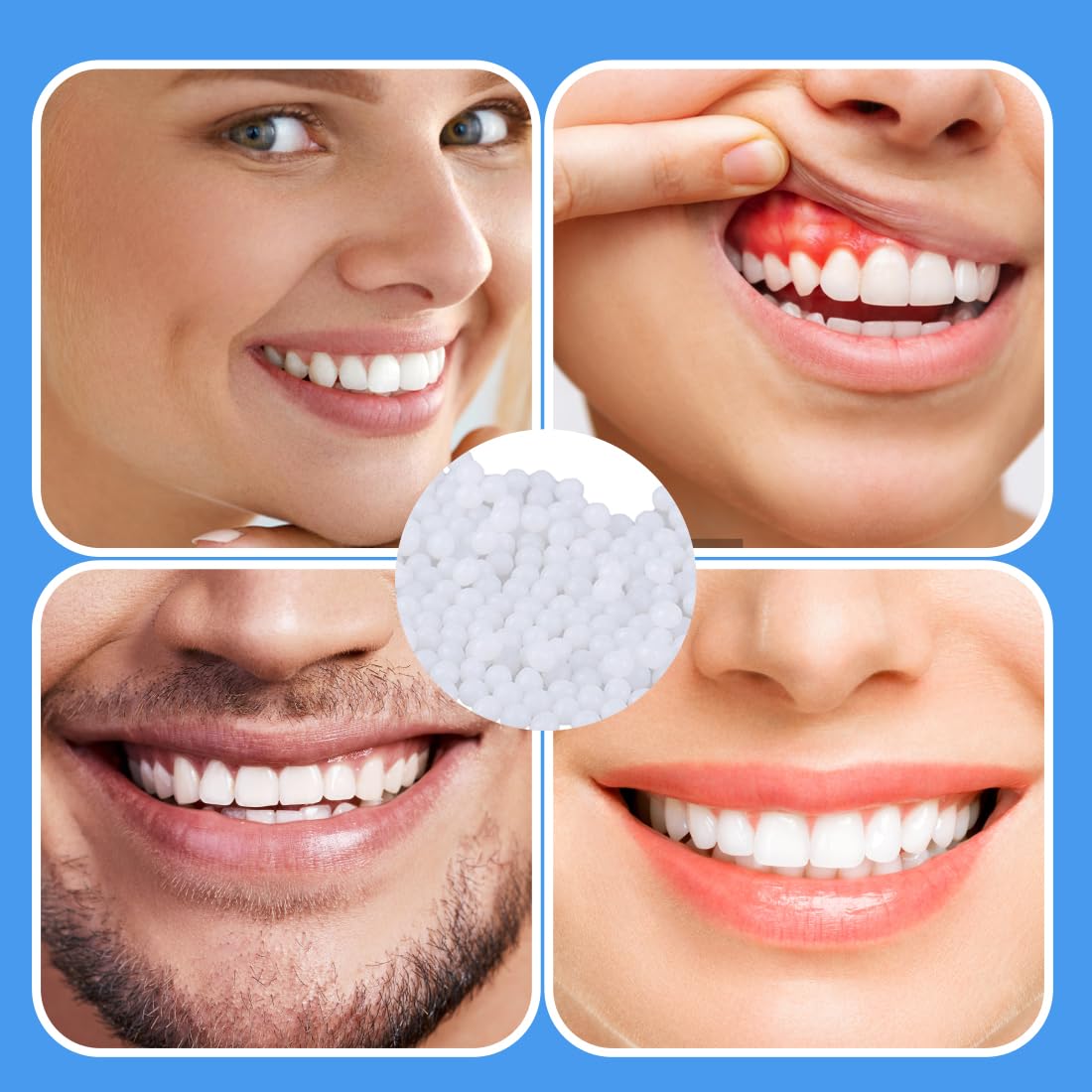 GXGM 100g Cemento per Denti Perline Temporanee di Riparazione dei Denti,Kit Riparazione Denti,Materiale di Riempimento Dei Denti Dental per Otturazioni,Cavità e Denti Scheggiati