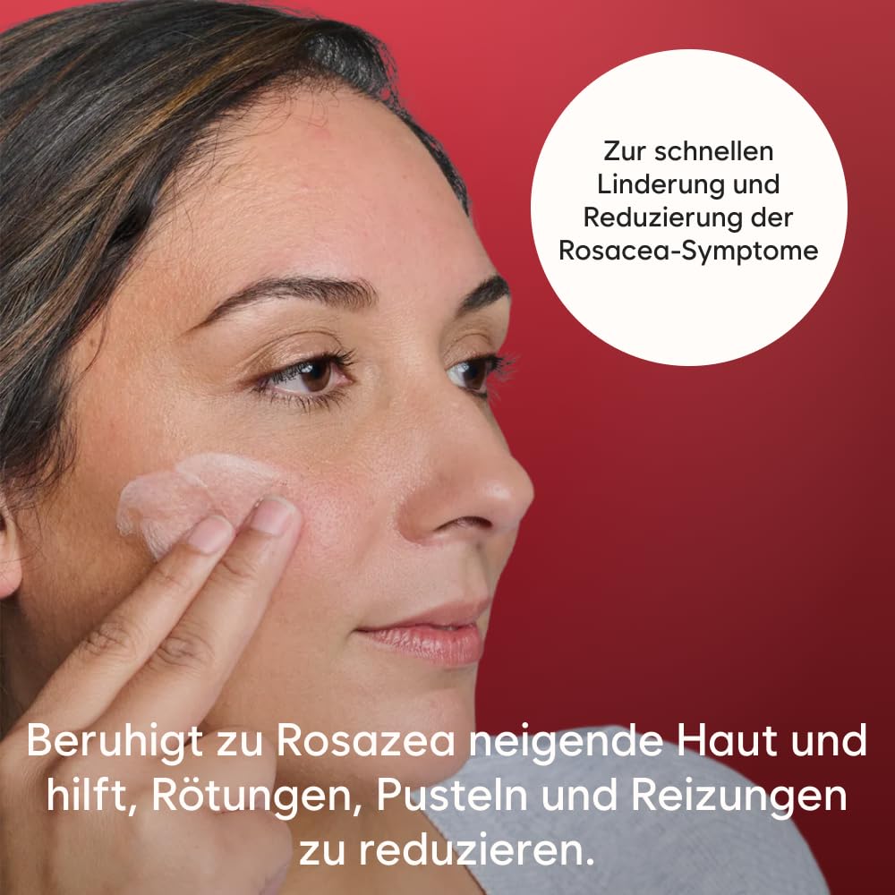 Gladskin ROSACEAR Cream für zu Rosacea neigende & empfindliche Haut (30ml) - Feuchtigkeitsspendende Gesichtscreme, dermatologisch getestet, parfümfrei & hypoallergen