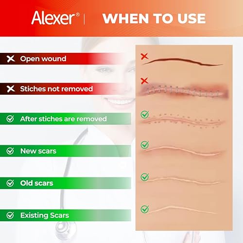 Miniatura 4 de Hojas de silicona para cicatrices, cinta de silicona para cicatrices, (rollo de 1.6 x 60 pulgadas - 4.9 ft), cinta de cicatriz para cicatrices