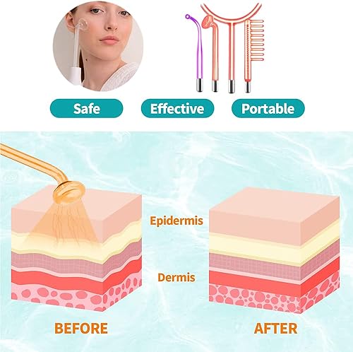Miniatura 4 de GESS Varita portátil de mano de alta frecuencia máquina masajeadora de varita facial 4 en 1 para antienvejecimiento ajuste de la piel reducción de