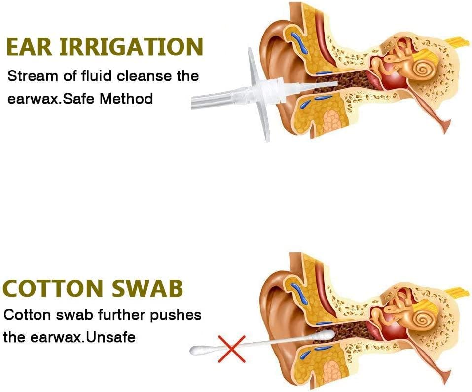 Ear Wax Removal Tool Kit, Ear Cleaner Elephant Ear Washer Bottle Ear Irrigation Kit, Ear Cleaning System for Adults&Kids, Included 5 Disposable Tips (300ML)