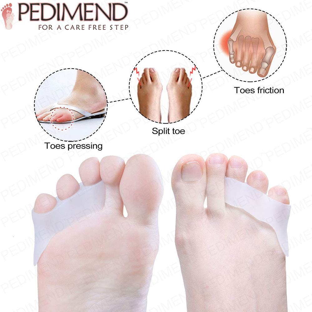 PEDIMEND Zehentrenner und Glätteisen aus Silikongel (1 Paar – 2 Stück), Zehentrenner für überlappende Zehen, Tailorenschutz, Unisex, Fußpflege