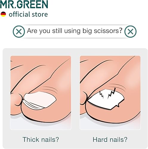 Miniatura 3 de MR.GREEN Cortador de uñas encarnadas de acero inoxidable, bueno para cortar uñas gruesas y duras, herramientas de pedicura (naranja)