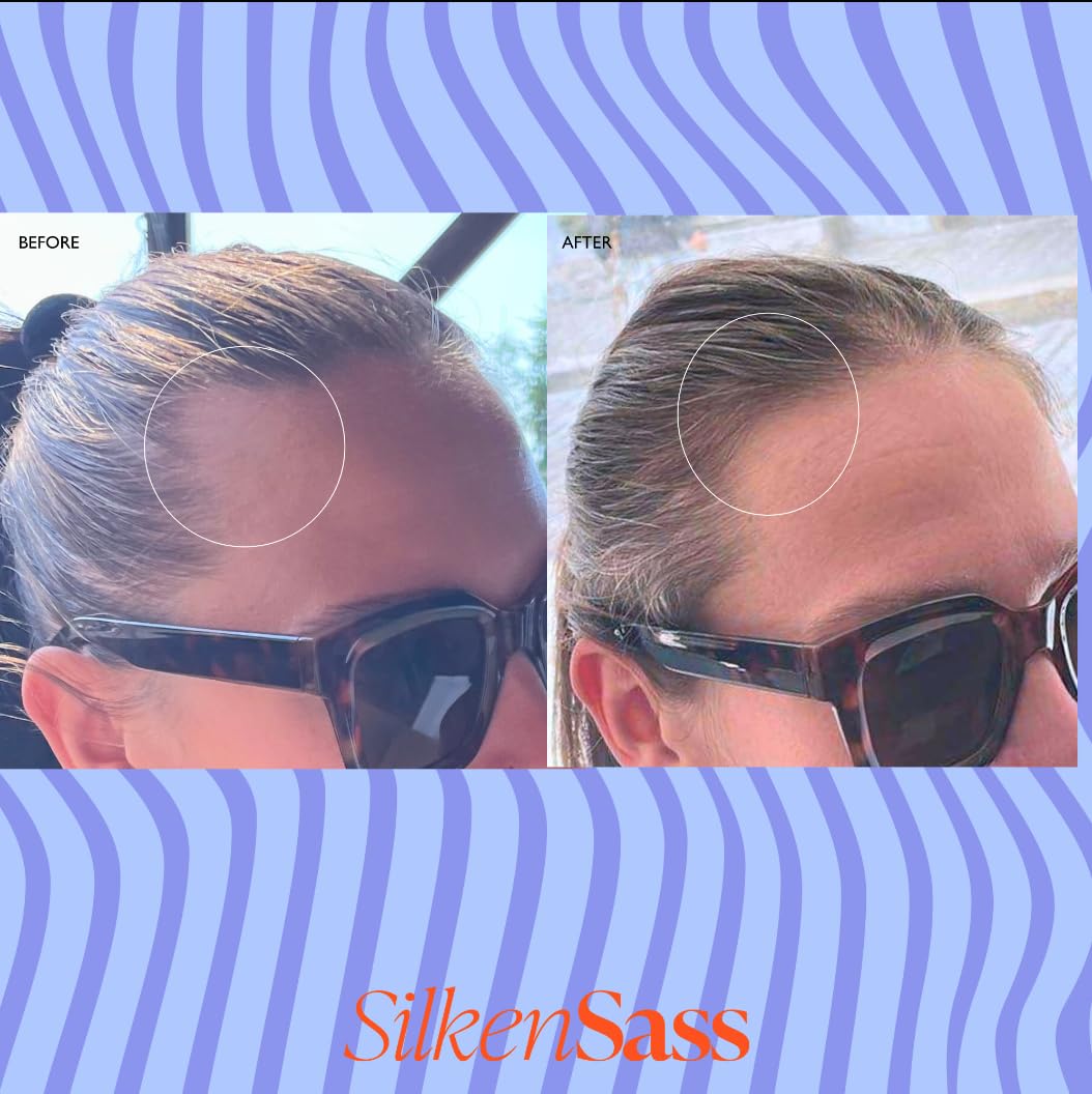 Silken Sass DHT Blocker Menopause Hair Care Treatment Root Revival Shampoo, Bounce Back Conditioner & Mane Gain Serum Botanical Formula for Thinning Hair & Breakage Reduction - Image 3