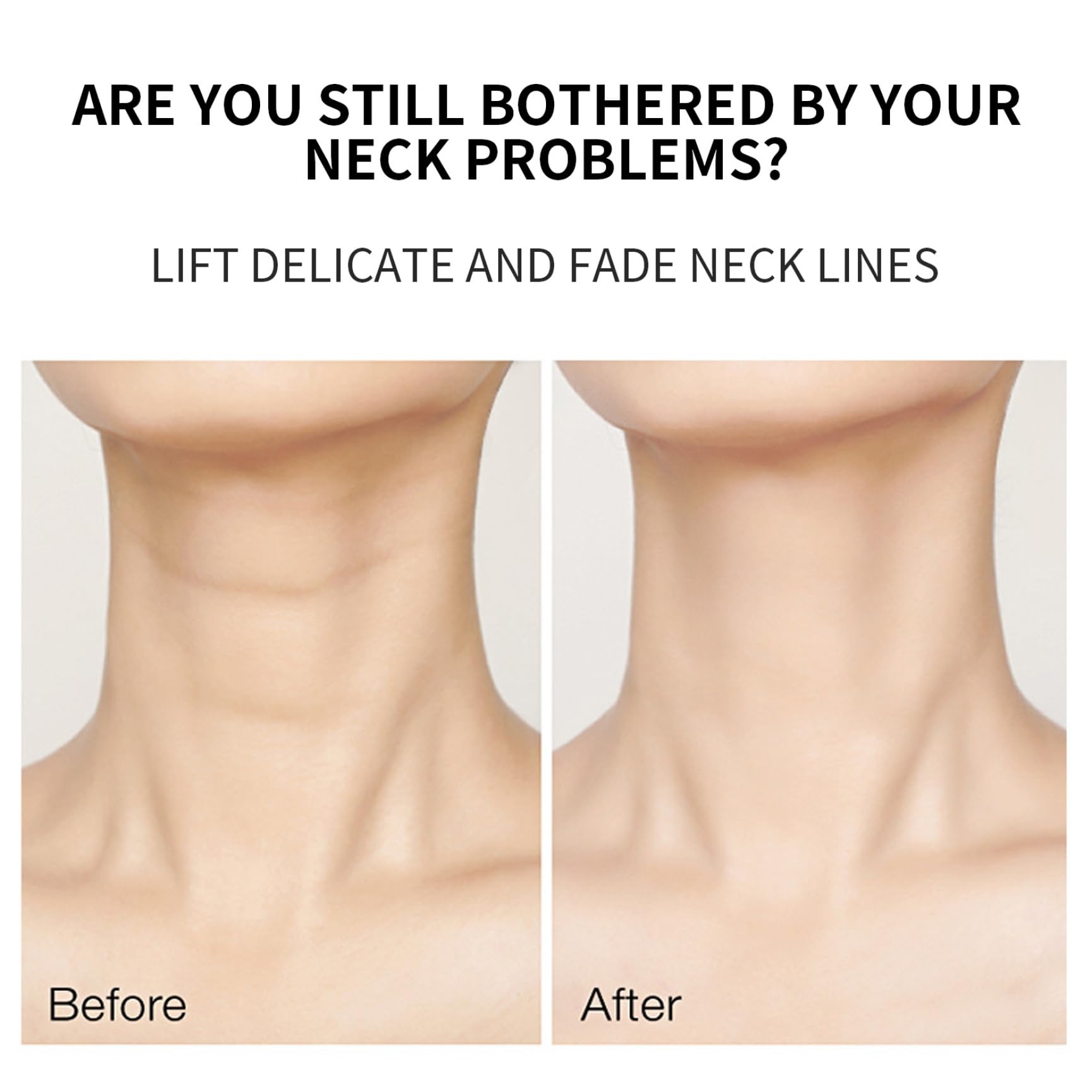 Bacchetta di frequenza, bacchetta ad alta frequenza, di di forma Y, pezzi di ricambio portano portatile ad alta, per acne