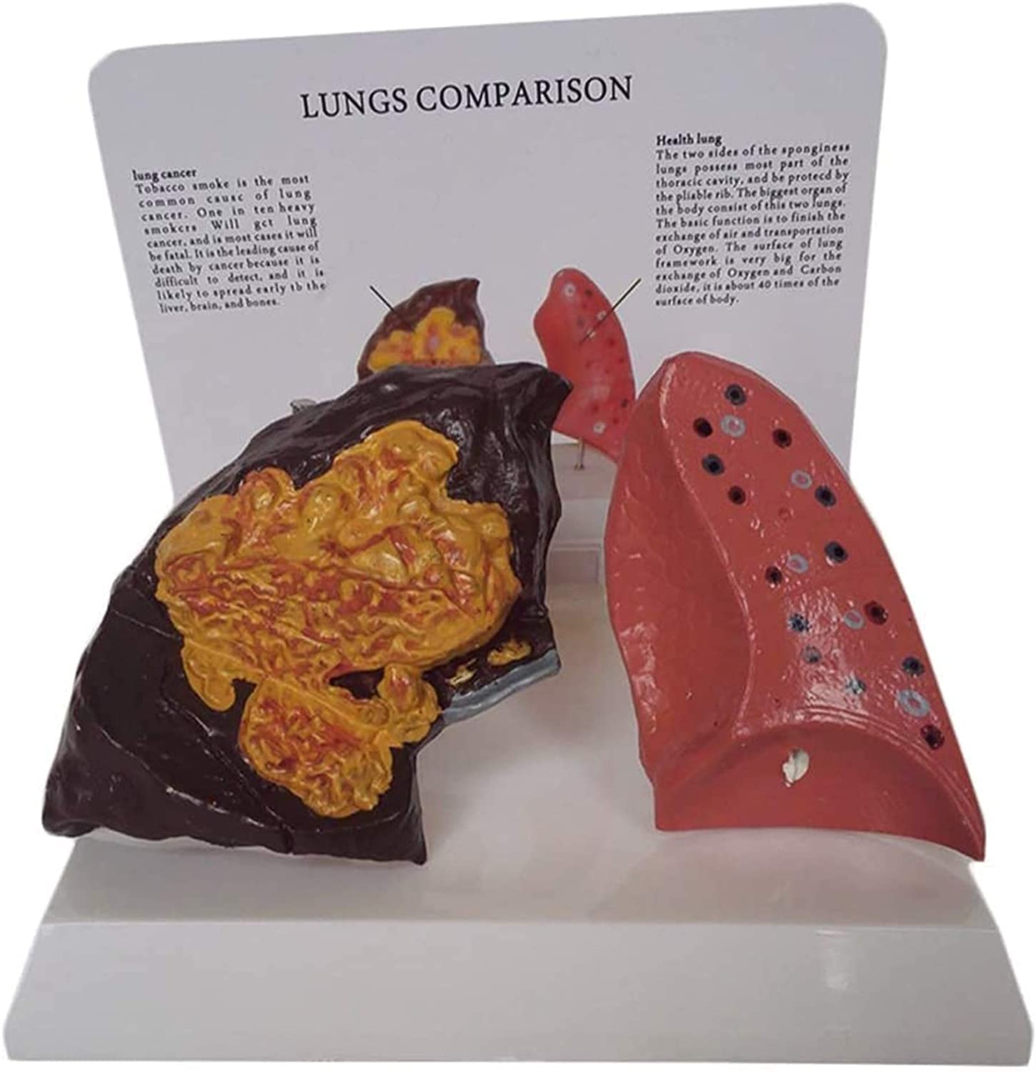Buy Lung Anatomy Model - Human Lung Model - Study Model Smoking Lung ...