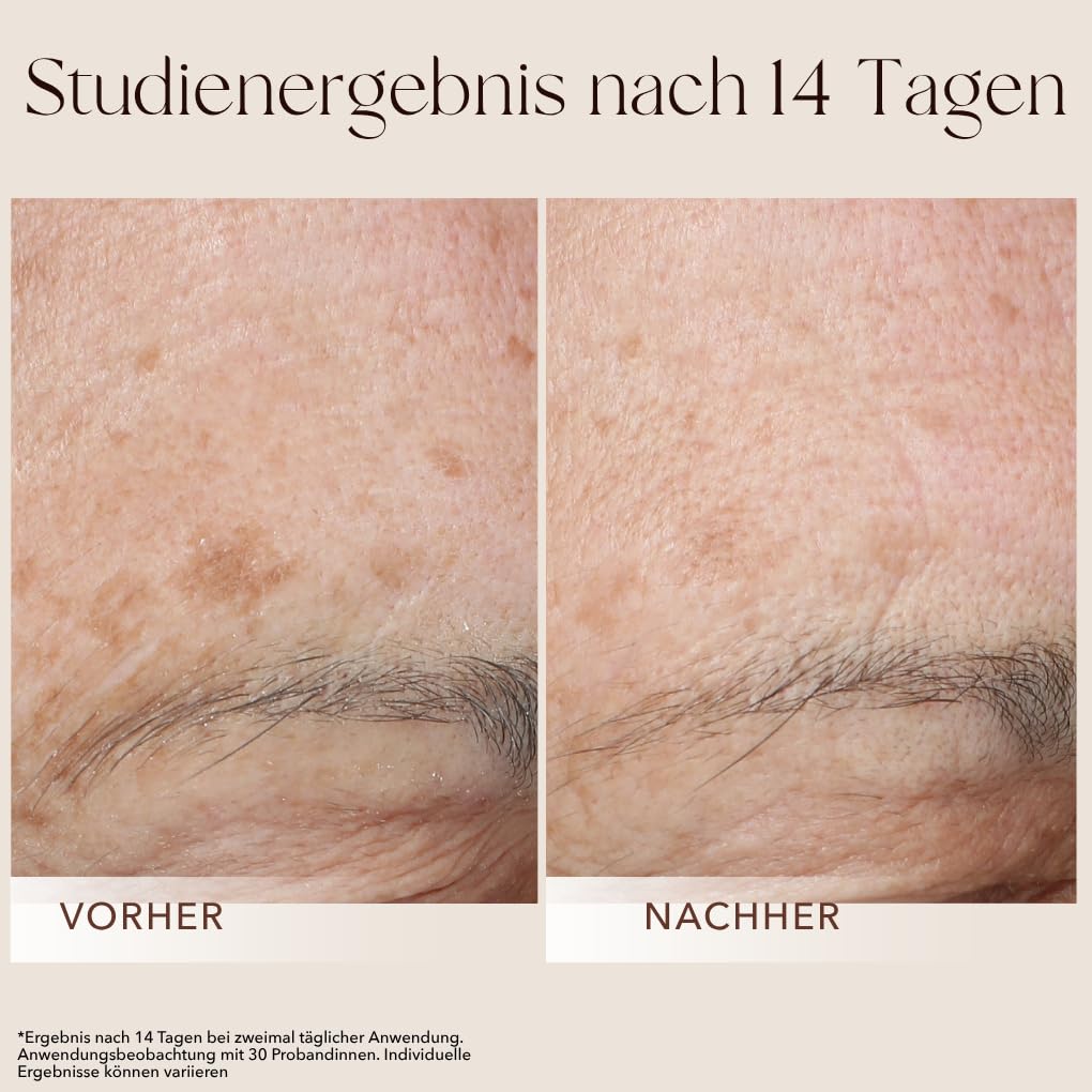 mellow NOIR XTREME Brightening Booster 30ml - Anti Pigmentflecken Serum - Reduziert dunkle Flecken, Altersflecken & Pickelmale im Gesicht und auf der Haut - Vegan - Zertifizierte Naturkosmetik