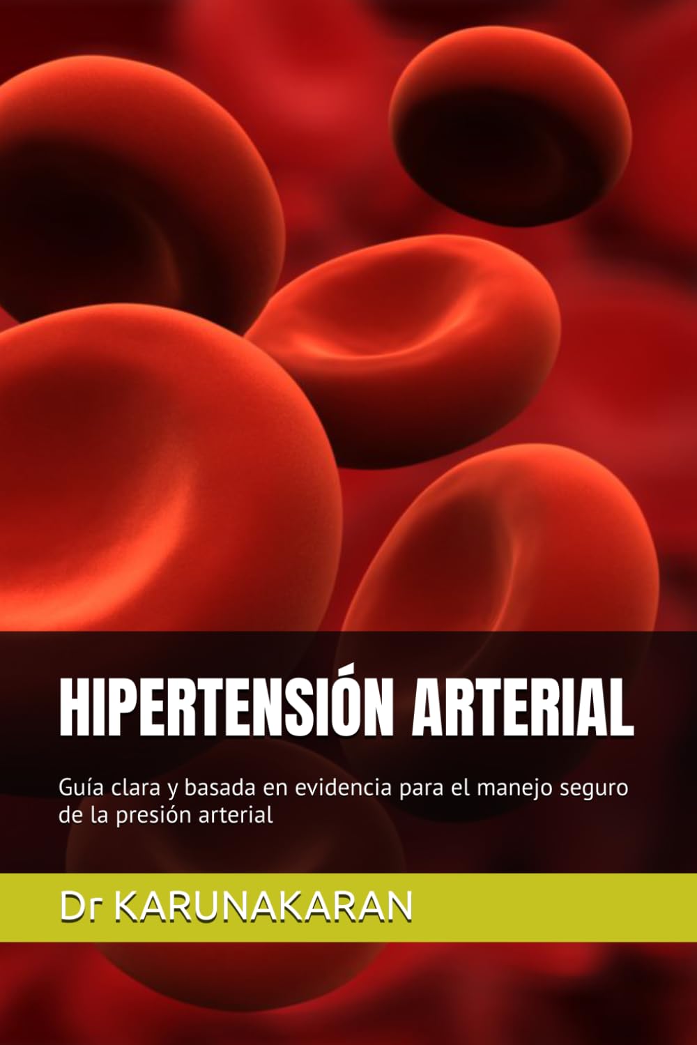 HIPERTENSIÓN ARTERIAL: Guía clara y basada en evidencia para el manejo seguro de la presión arterial (Salud Hecha Simple)