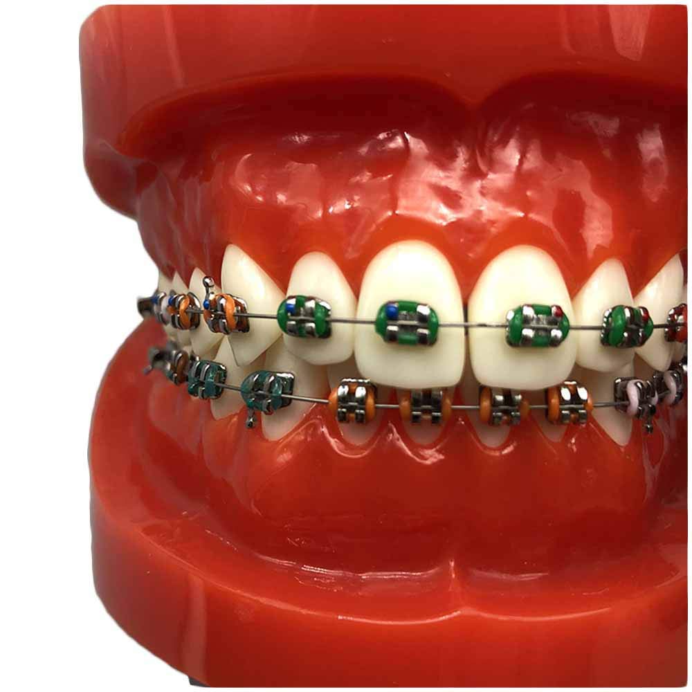 Modello di Denti Ortodontici Tipodonte Dentale con Staffe Mentali Denti Ortodontici con Legature Rosse