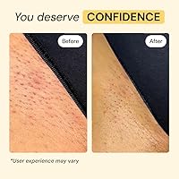 Vista 5 de MyMagicHealer Cuidado de Brotes de Tomillo y Árbol de Té Cabello encarnado, protuberancias de afeitar, espinillas ciegas, bartolín, quistes