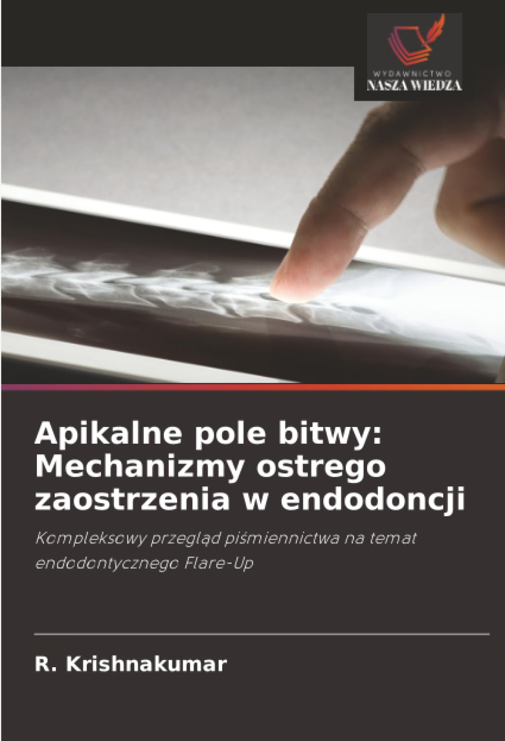 Apikalne pole bitwy: Mechanizmy ostrego zaostrzenia w endodoncji: Kompleksowy przegląd piśmiennictwa na temat endodontycznego Flare-Up