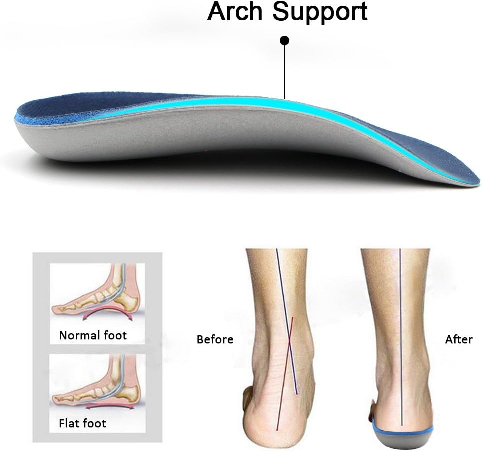 fallen arch support insoles