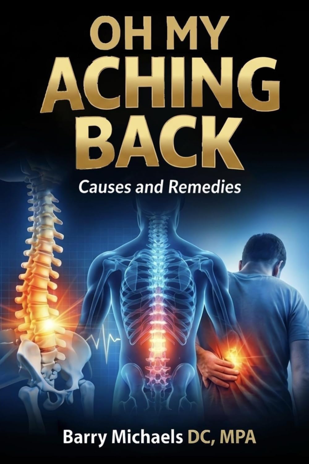 Oh My Aching Back: Causes and Remedies (SERIES 2 — The Pain & Relief Essentials Understanding common sources of pain and practical ways to manage them.)