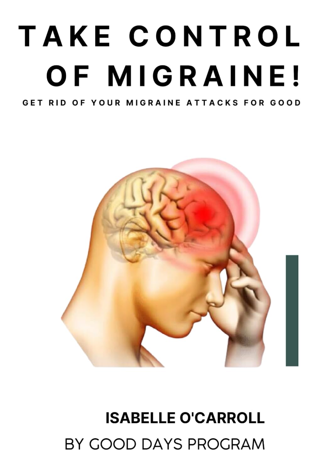 Take Control of Migraine!: Get rid of your migraine attacks for good