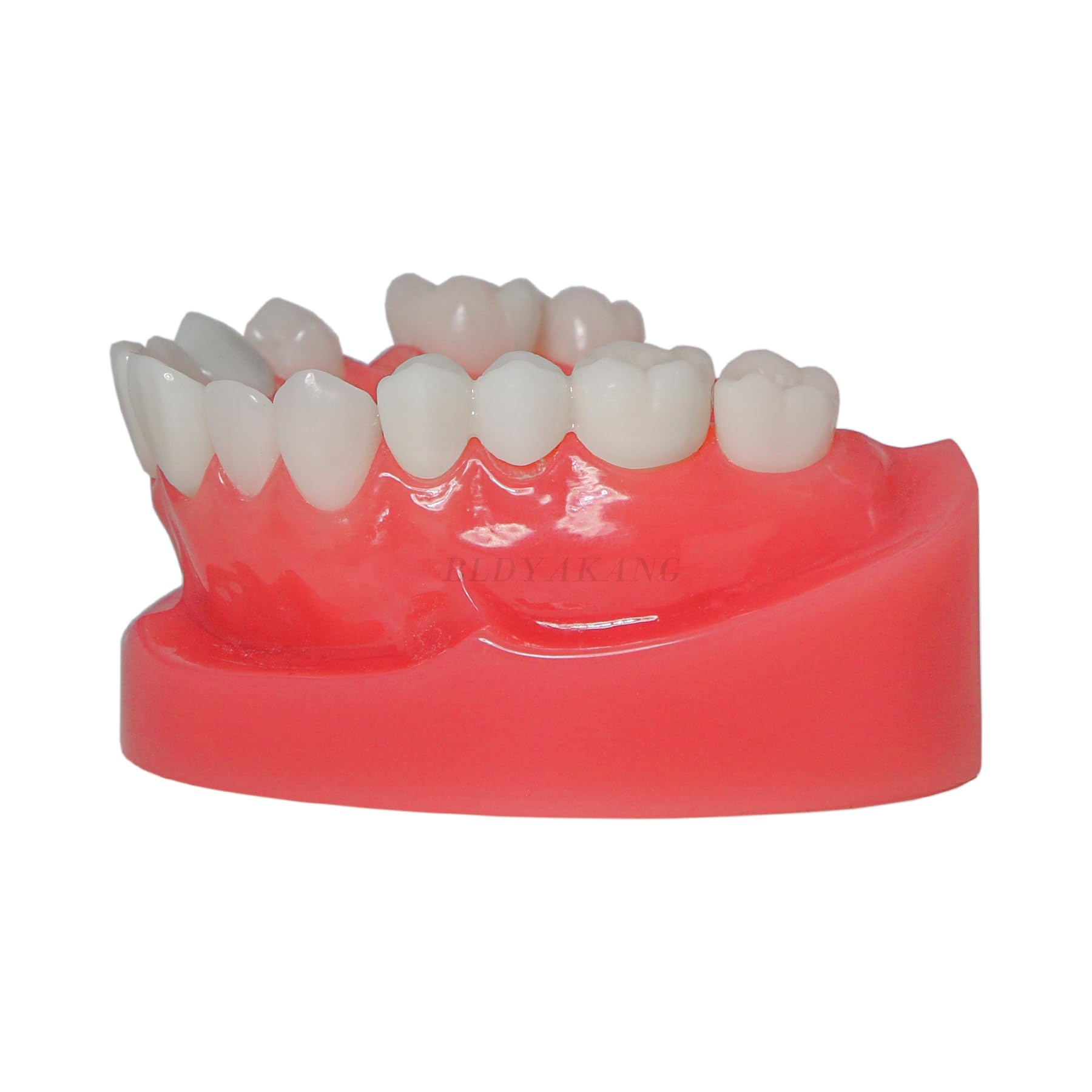Dental Implant, Dental Bridges Restoration Model Dental Typodont Teach Study Education Dentist to Communicate with Patients Model (M6024)