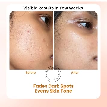 TRUTH & BEAUTY Vitamin C Serum for Face With Hyaluronic and Ferulic Acid, Boost Skin Collagen,Hydrate & Plump Skin, Anti Aging & Wrinkle Facial Serum - 1.01 Fl Oz Advance