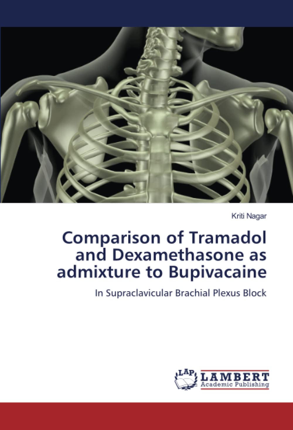Comparison of Tramadol and Dexamethasone as admixture to Bupivacaine: In Supraclavicular Brachial Plexus Block