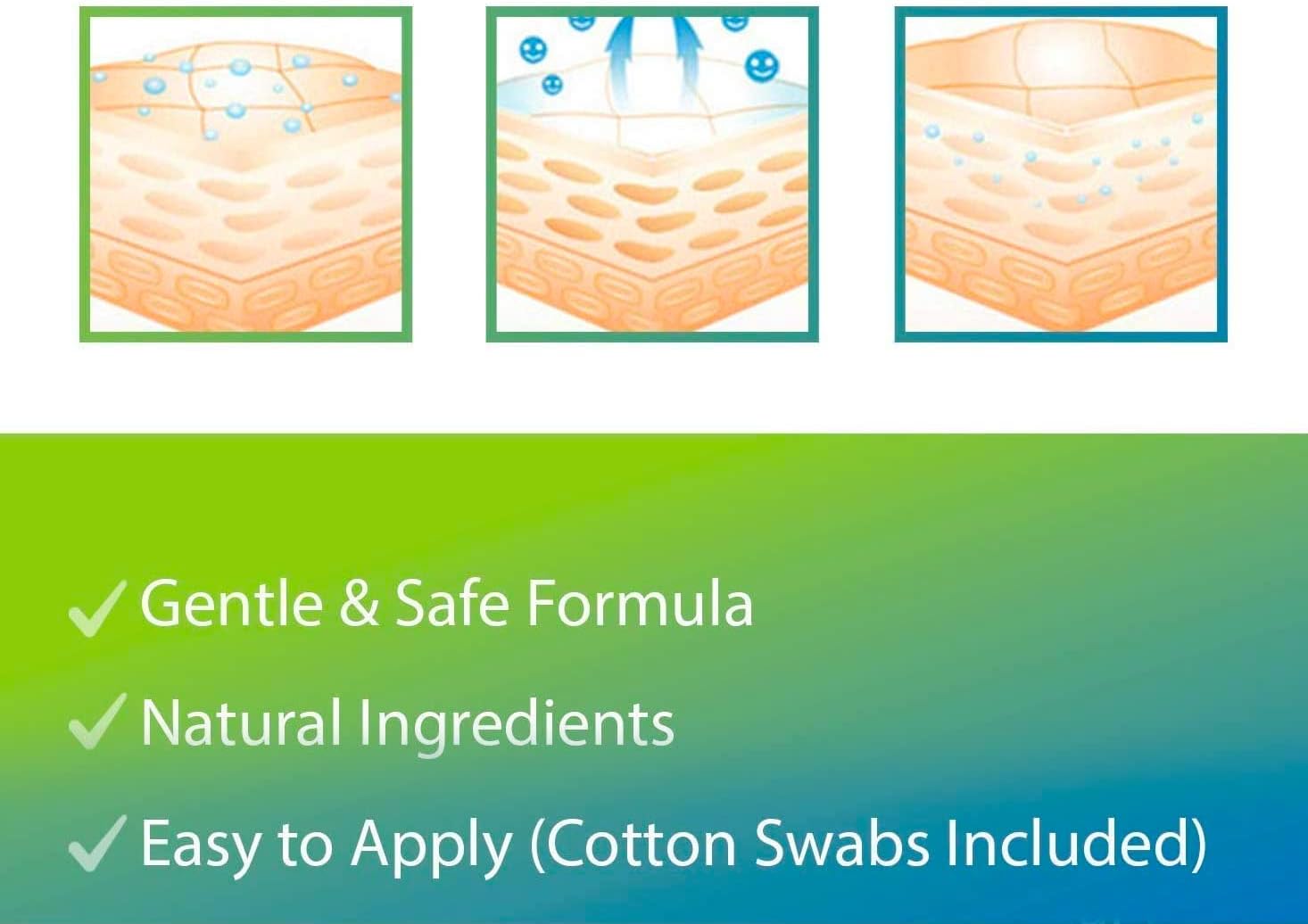 Evagloss Natural Wart Remover, Maximum Strength, Painlessly Removes Plantar, Common, Genital Warts, Advanced Liquid Gel Formula, Proven Results : Health & Household