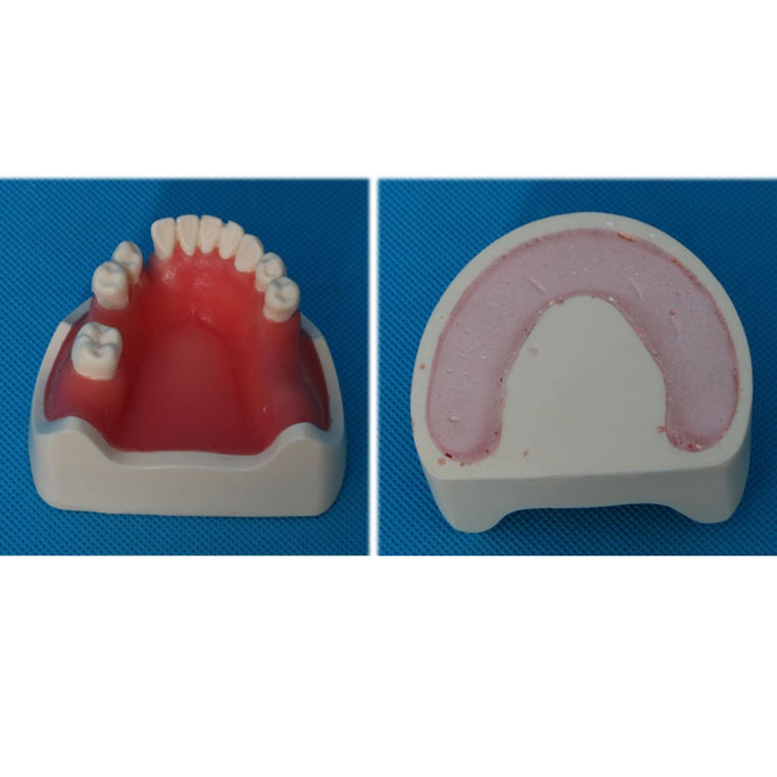Modello di impianto Dentale - Modello di impianto mandibolare Medico e odontoiatrico - per Studio didattico Displaymedical Model,A5-8cm