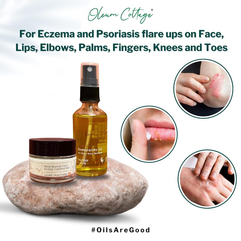 Image of Oleum Cottage Skincare Bundle for Small Patches on the Body for Eczema, Psoriasis and Dermatitis | Contains Restorative Oil and Ultra Healing Cream | Reduces Itchiness and Soothes Flare-Ups