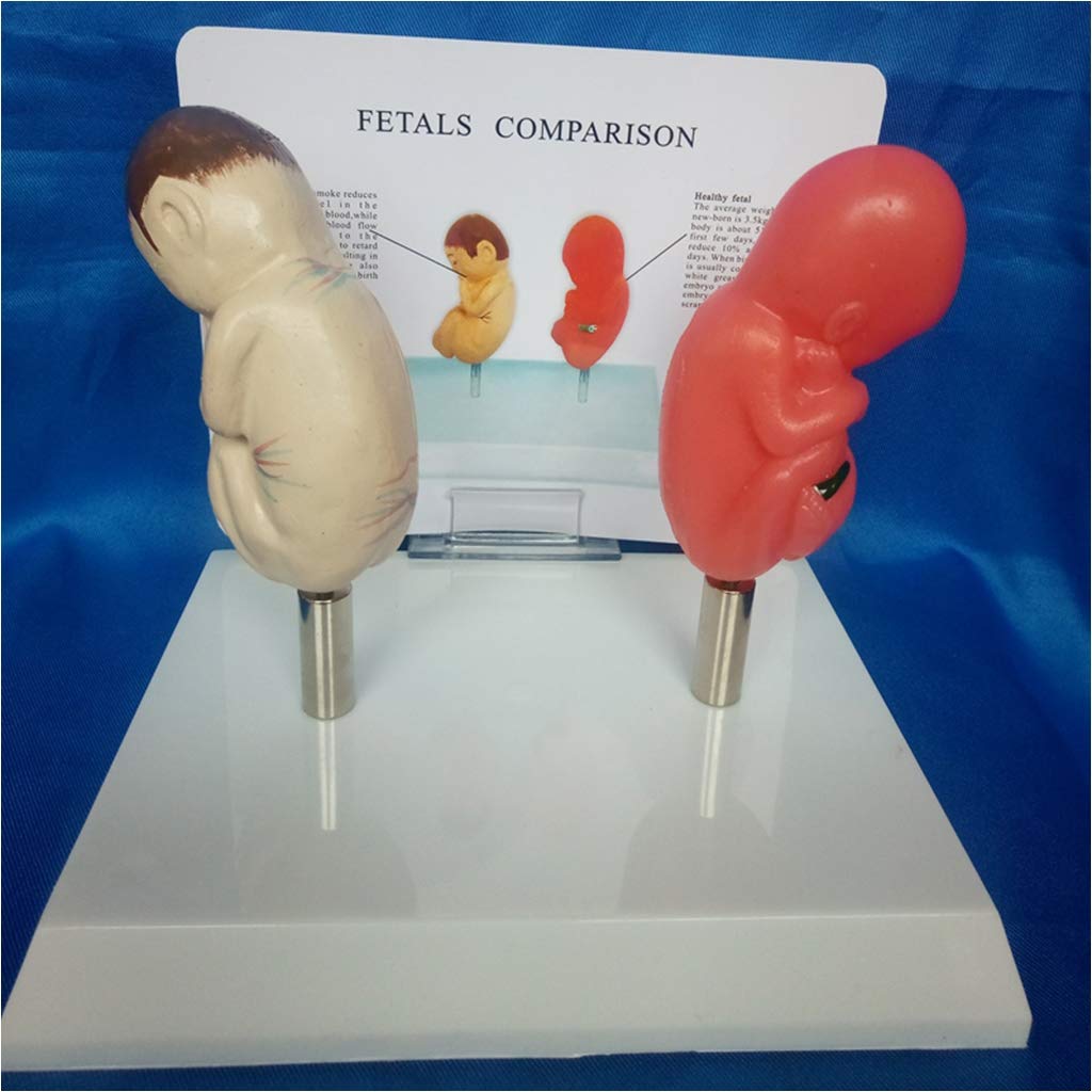 Model płodu-płód palący i normalny Model porównawczy płodu-materiał PCV modele naukowe anatomii człowieka-do wyświetlania w celach dydaktycznych model medyczny