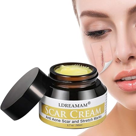 top 10 acne scar removal cream