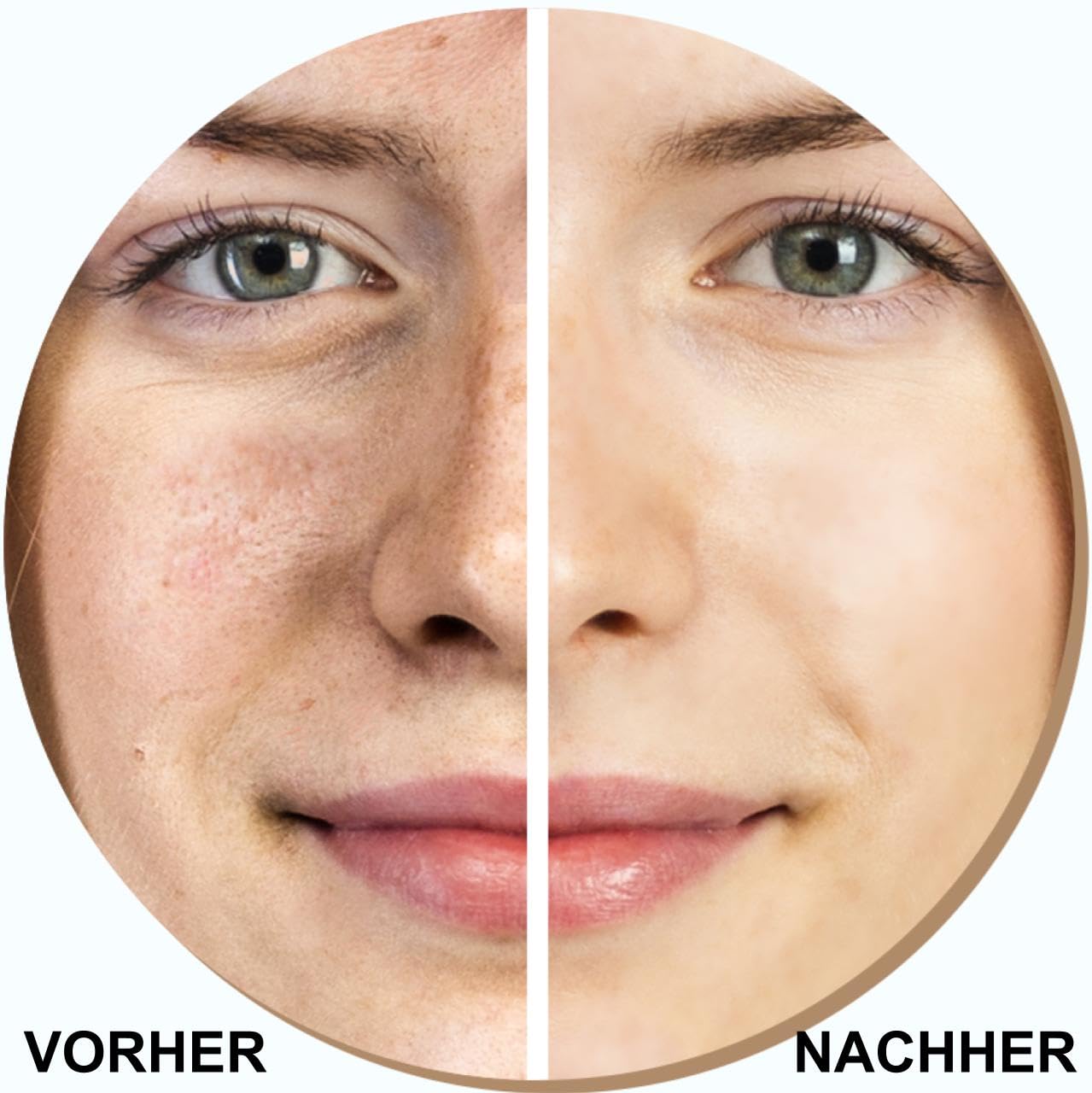 LUMINEO Lifting Ultraschallpeelinggerät 5 in 1, (ION- ION+), EMS, LED-Lichttherapie, Set mit professioneller Lifting-Kosmetik, Tiefenreinigung, Mitesser-Entfernung.