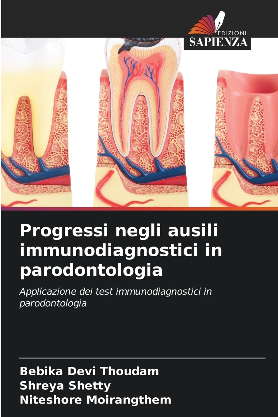 Progressi negli ausili immunodiagnostici in parodontologia: Applicazione dei test immunodiagnostici in parodontologia