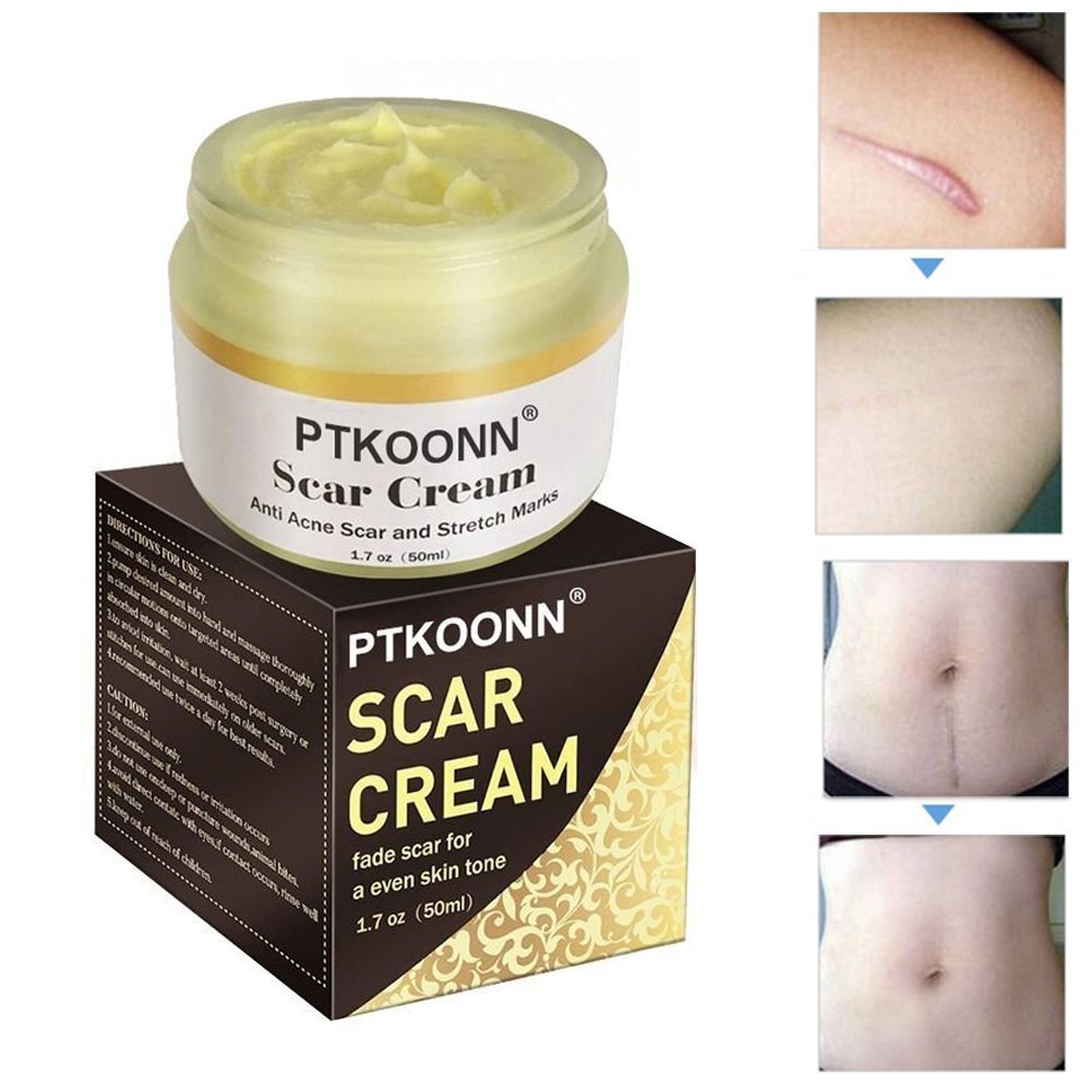 Professional Barber Straight Edge Cut throat razor black and gold clip - Includes 100 single edge razors