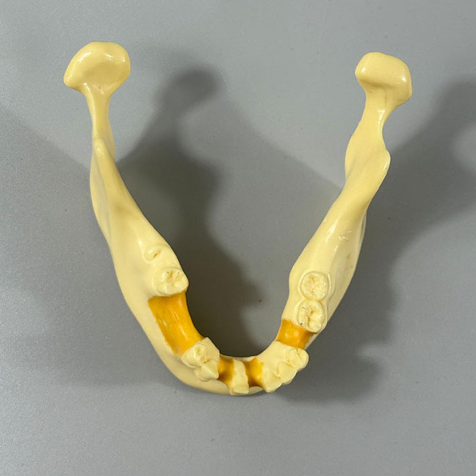 Model szczęki dentystycznej do praktyki implantologicznej, żuchwy do wiercenia i wkładania, idealny do treningu stomatologicznego i praktyki implantów zębów, do skutecznej praktyki