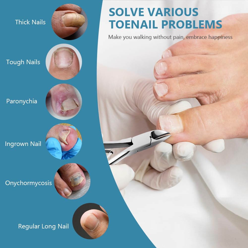 Beugo Pince Coupe Ongles, Pinces à Ongle Incarné en Acier Inoxydable Professionnelle avec Capuchon en Plastique Ciseaux à Cuticules pour Couper les Ongles Épais（B）