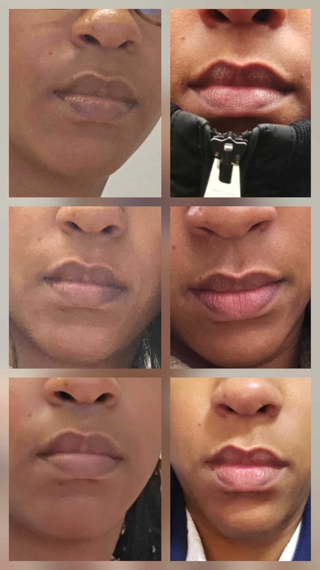 Generic Lip Lightening for Dark Lips, Lip Brightening for Dark Lips, Dark Lip Treatment Serum for Smokers, Dry or Uneven, Restores Natural Look & Moisture with VC, Licorice & Jojoba Seed Oil