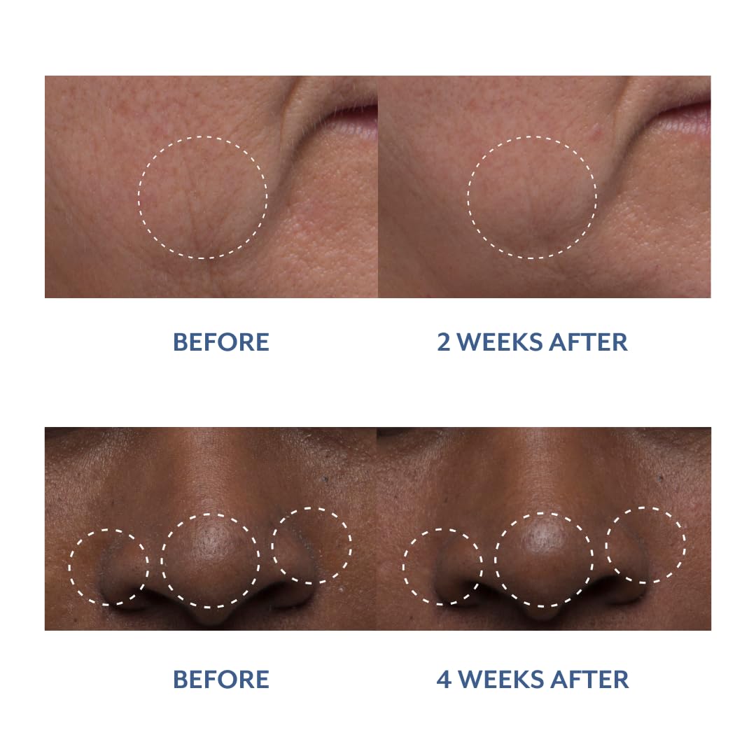 Bloomeffects - Natural Tulip Dew Drops Multi-Nutrient Serum | Cruelty-Free, Non-Toxic, Clean Beauty (1.0 oz | 30 ml) - Image 7