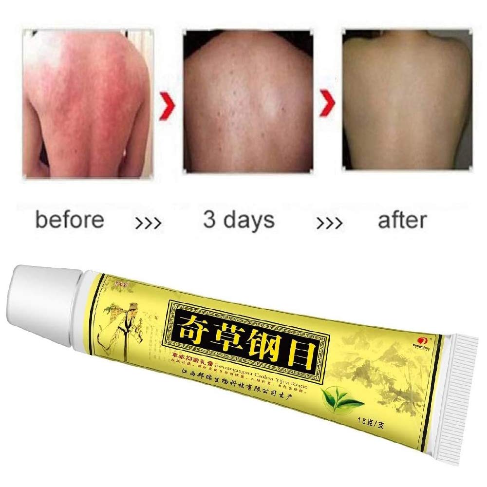 Natural Chinese Herbal Cream Chines Medicine Cream AntiItch Cream External Use Only,Dermatitis