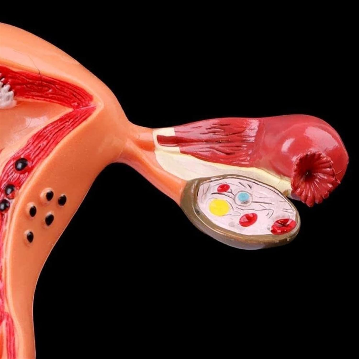 Modèle de pathologie de l'utérus féminin Humain Modèle d'anatomie de l'ovaire de l'utérus pathologique féminin Humain Modèle d'étude Anatomique en Coupe transversale