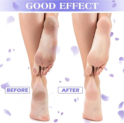 Miniatura 9 de Tarpop 3 pares de calcetines de aloe hidratantes para pies secos y agrietados, calcetines con infusión de gel para dormir, calcetines de loción,