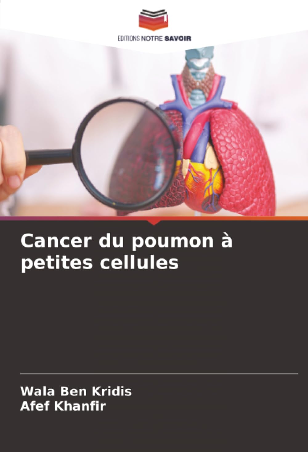Cancer du poumon à petites cellules