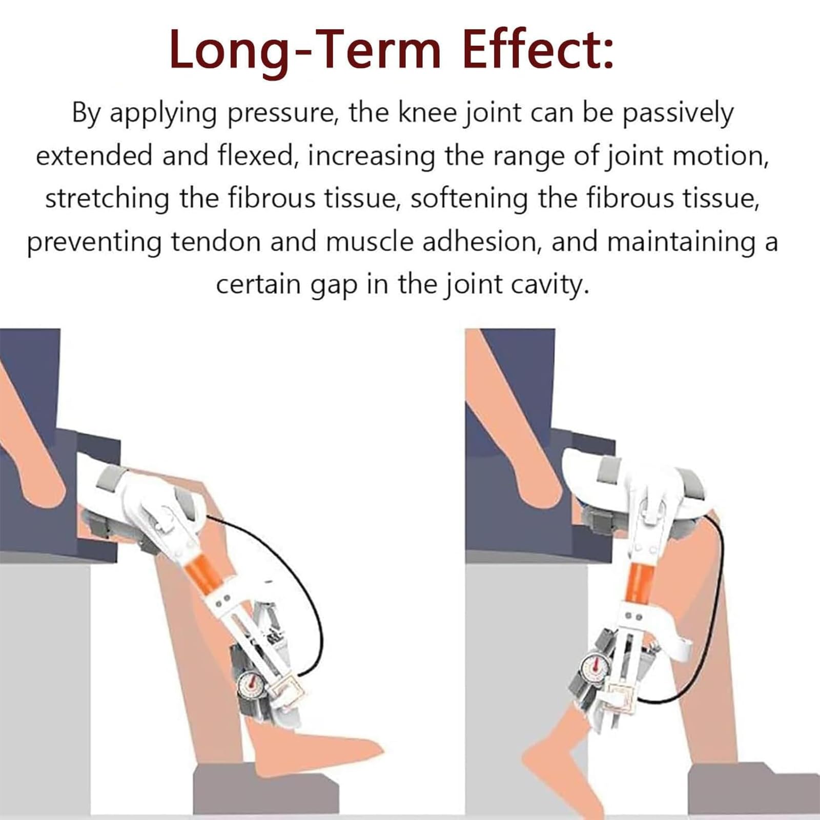 Trainer per La Riabilitazione Dell'articolazione del Ginocchio, Dispositivo per L'allenamento Dell'estensione delle Gambe, Estensione a -10° E Flessione a 140°
