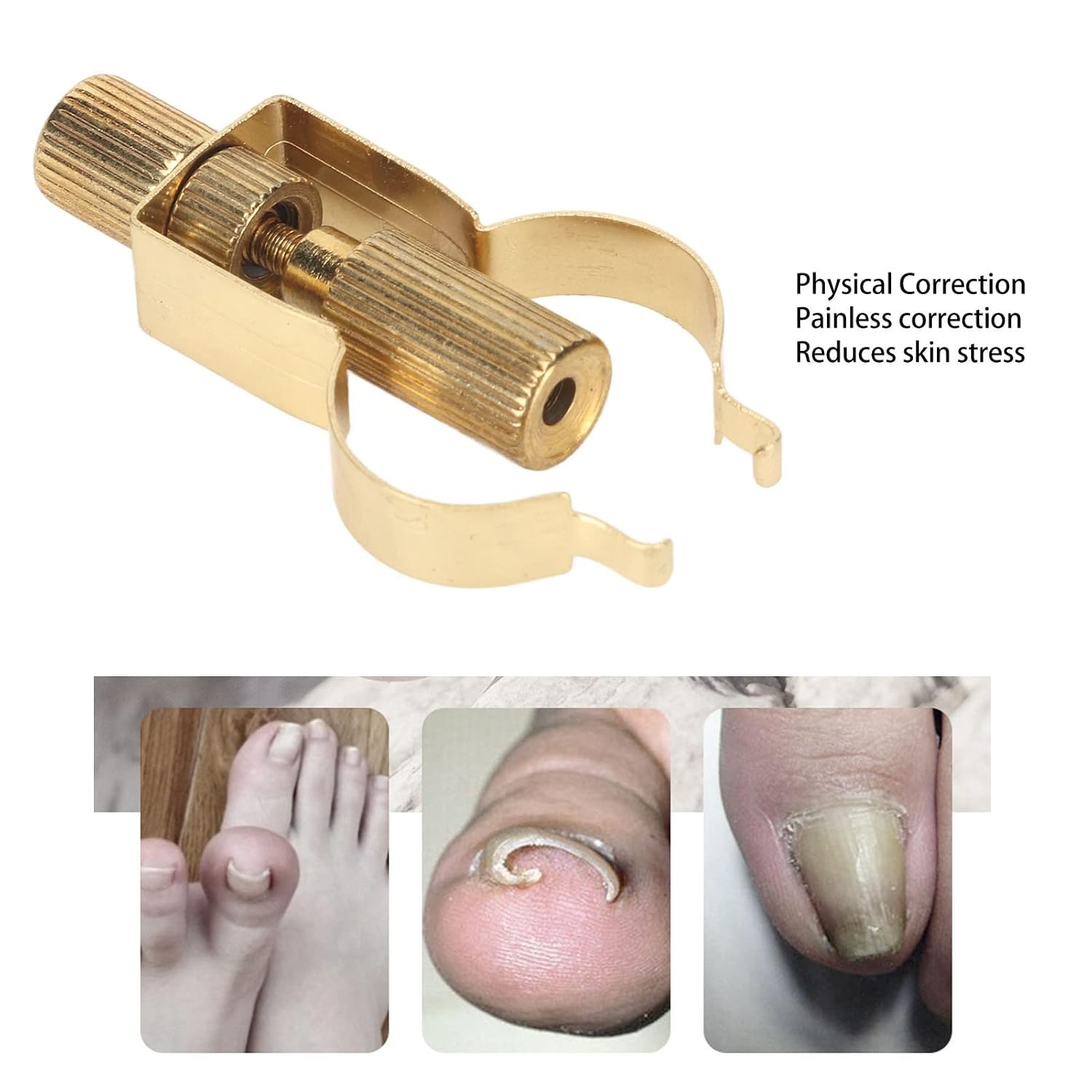 Ingrown Toenail Lifter Foot Care Tool Toenail Clamp Stainless Steel Ingrown Toenail Tools Stainless Steel Professional For Paronychia, Ingrown Toenail Clamp (Gold)