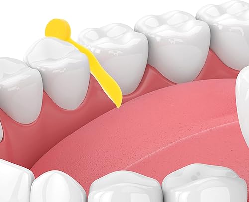 Miniatura 8 de DOITOOL 100 piezas de plástico dental cuñas PC dientes cuña herramienta auxiliar de llenado de dientes para tratamiento endodóntico (amarillo)