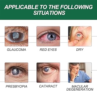 Seurico Presbyopia Eye Drops,Optivipro Presbyopia Eye Drops,Optivipro Eye Drops,Presbyopia Recovery Treatment Eye Drops,Presbyopia Vision Recovery Eye Drops,Brightening Eye Drops for Dry Eye (3 Pcs)