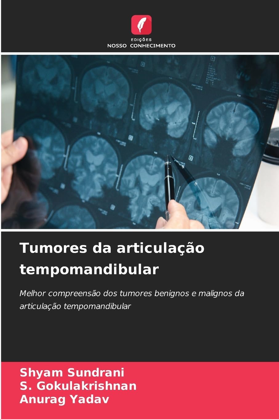 Tumores da articulação tempomandibular: Melhor compreensão dos tumores benignos e malignos da articulação tempomandibular