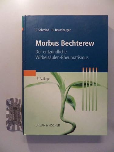 Morbus Bechterew: Der entzündliche Wirbelsäulen-Rheumatismus