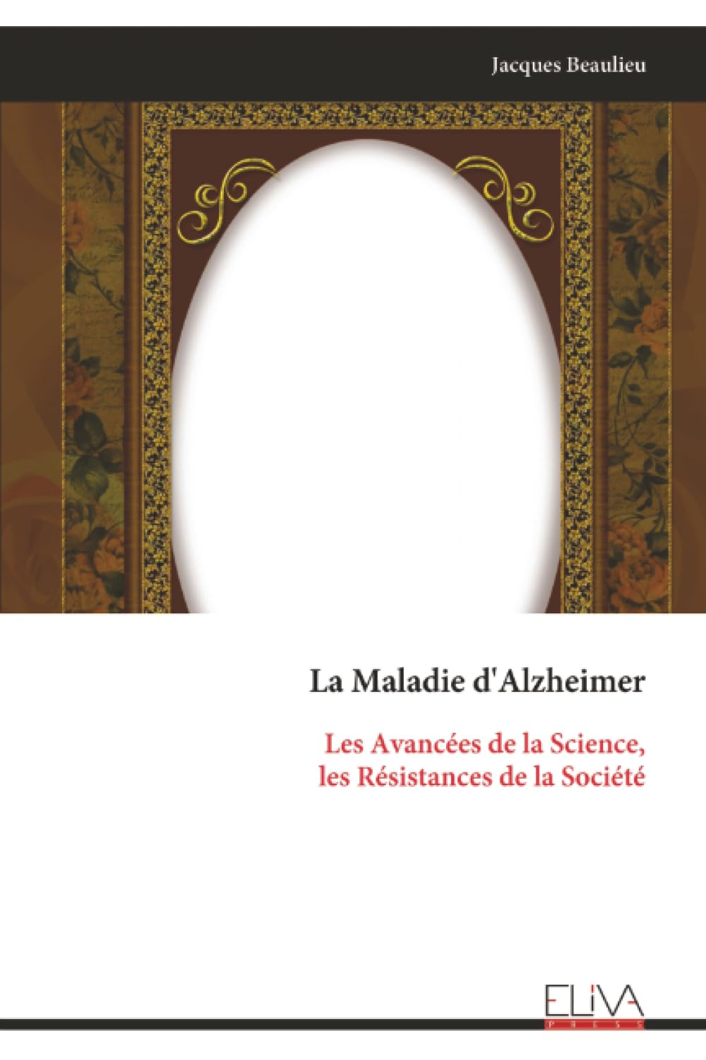 La Maladie d'Alzheimer: Les Avancées de la Science, les Résistances de la Société